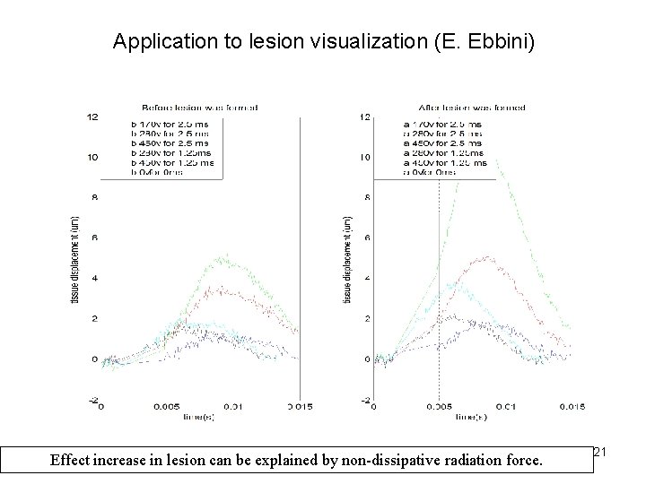 Application to lesion visualization (E. Ebbini) Tissue Displacement (0. 9 mm away from the