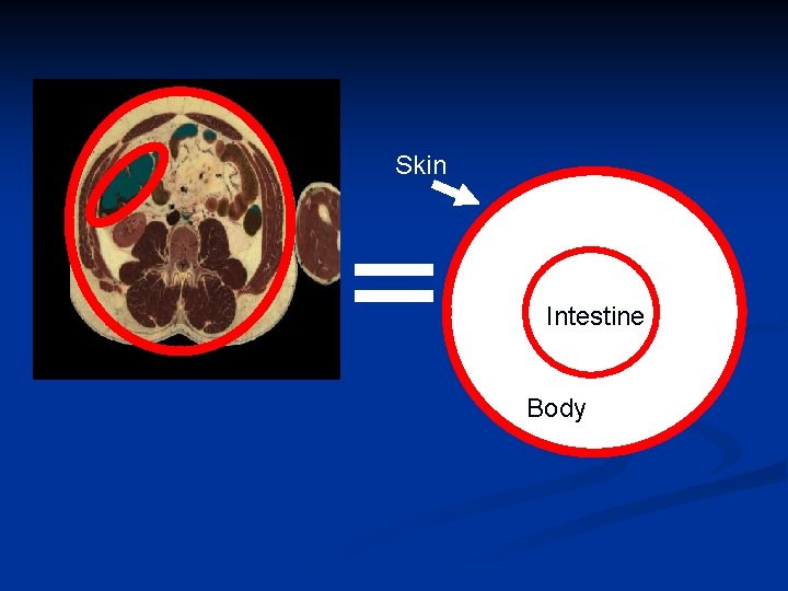 Skin Intestine Body 