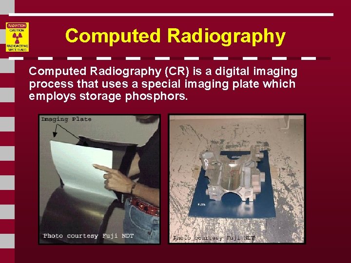Computed Radiography (CR) is a digital imaging process that uses a special imaging plate