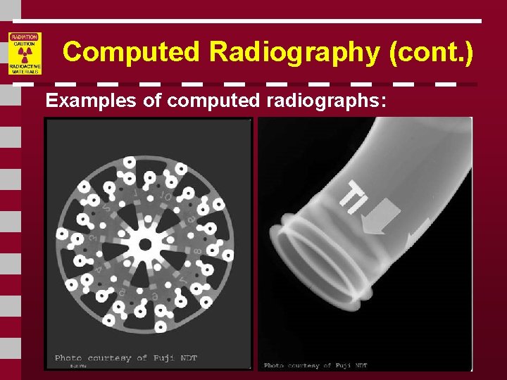 Computed Radiography (cont. ) Examples of computed radiographs: 