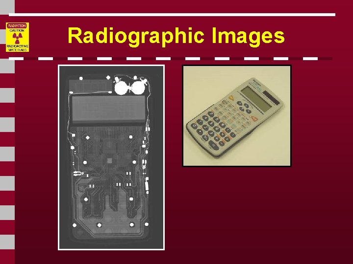 Radiographic Images 