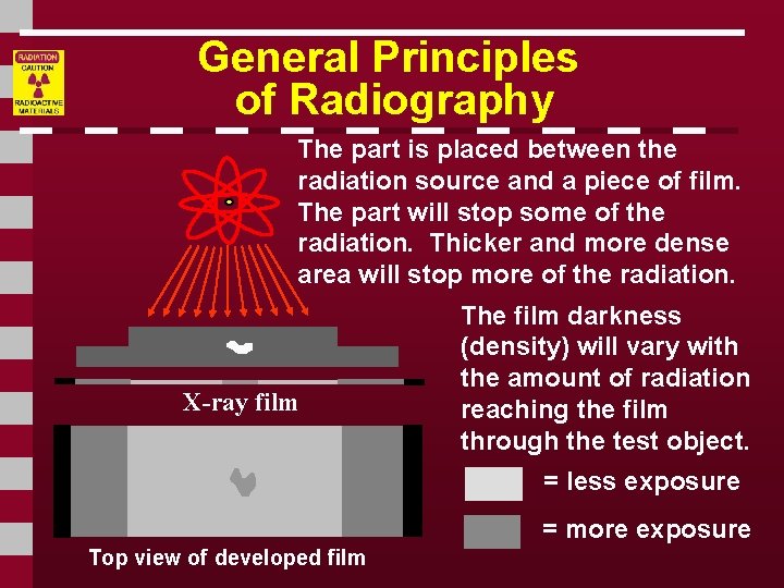 General Principles of Radiography The part is placed between the radiation source and a