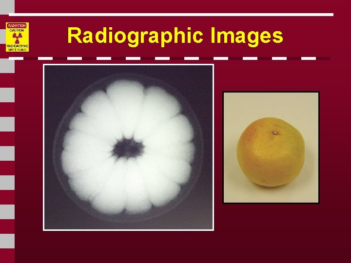 Radiographic Images 