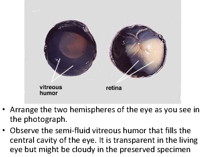  • Arrange the two hemispheres of the eye as you see in the