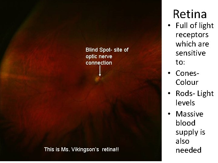 Retina Blind Spot- site of optic nerve connection This is Ms. Vikingson’s retina!! •