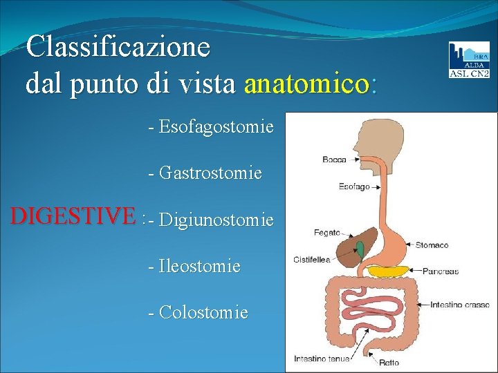 Classificazione dal punto di vista anatomico: - Esofagostomie - Gastrostomie DIGESTIVE : - Digiunostomie