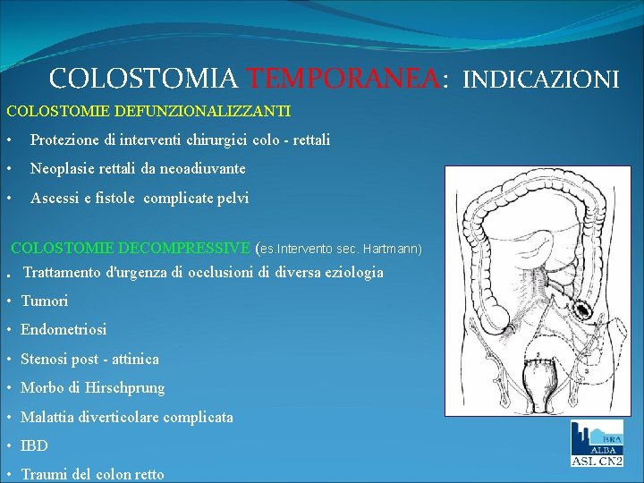 COLOSTOMIA TEMPORANEA: INDICAZIONI COLOSTOMIE DEFUNZIONALIZZANTI • Protezione di interventi chirurgici colo - rettali •