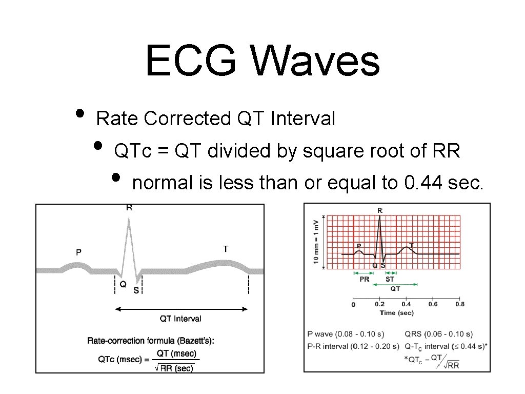 ECG Waves • Rate Corrected QT Interval • QTc = QT divided by square