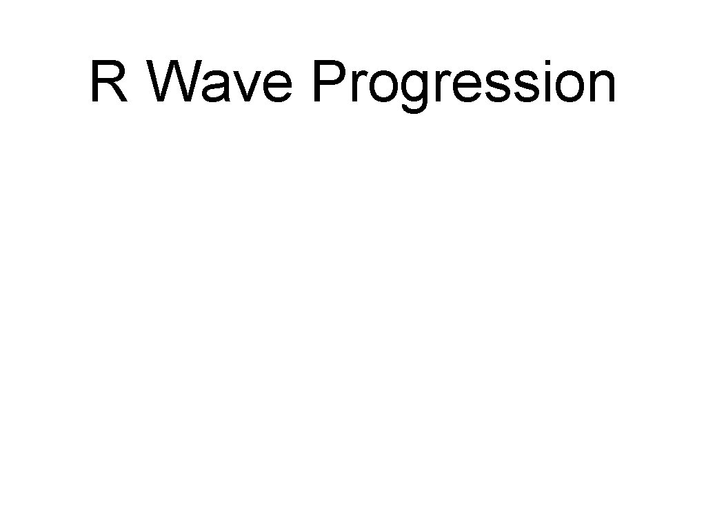 R Wave Progression 