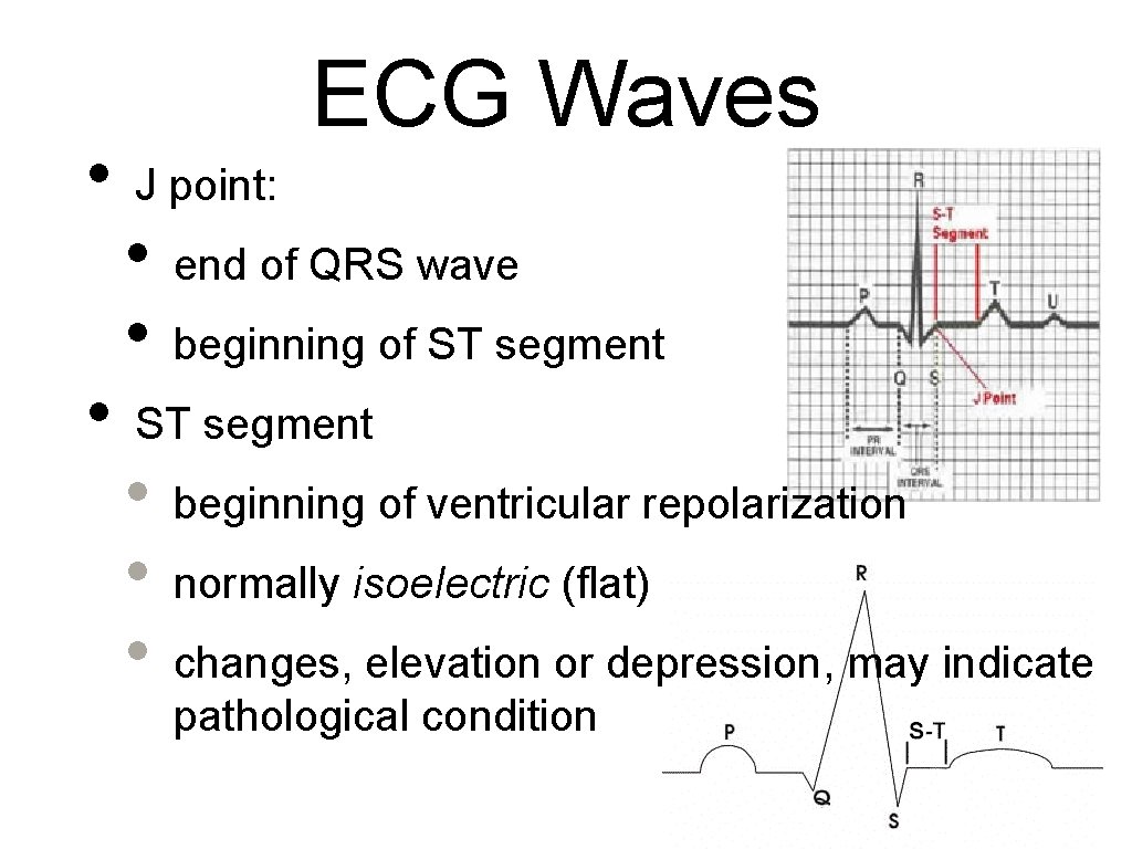  • • ECG Waves J point: • • end of QRS wave beginning