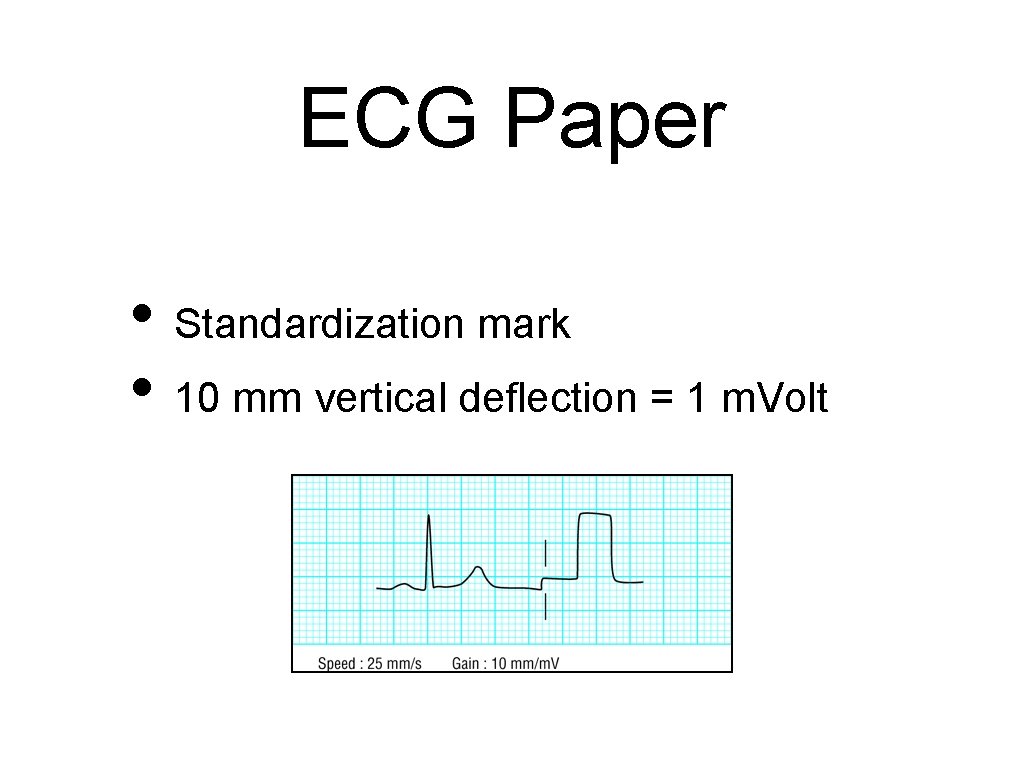 ECG Paper • Standardization mark • 10 mm vertical deflection = 1 m. Volt