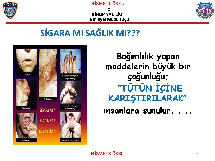 HİZMETE ÖZEL T. C. SİNOP VALİLİĞİ İl Emniyet Müdürlüğü SİGARA MI SAĞLIK MI? ?