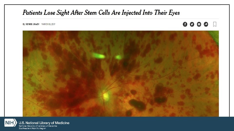 Patients lose sight after stem cells are injected into their eyes: NYTimes article URL