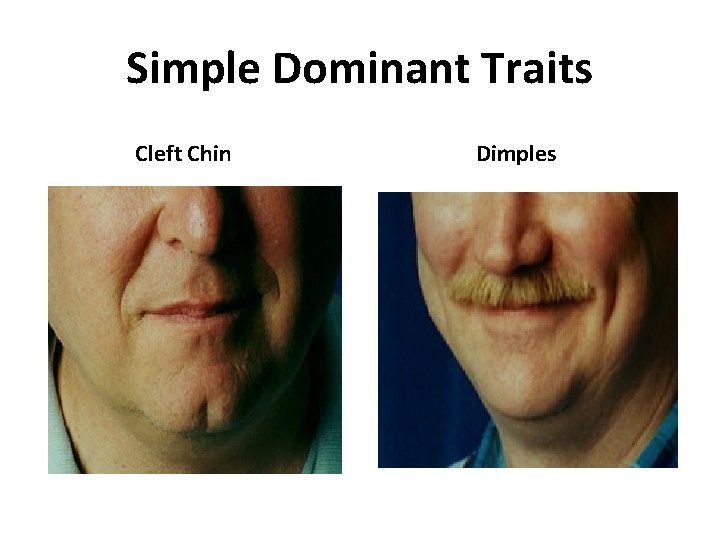 Simple Dominant Traits Cleft Chin Dimples 