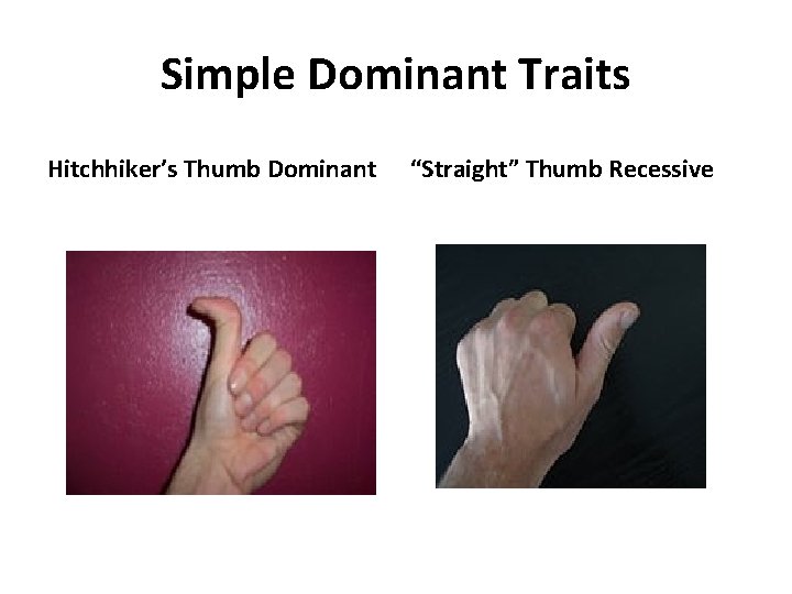 Simple Dominant Traits Hitchhiker’s Thumb Dominant “Straight” Thumb Recessive 