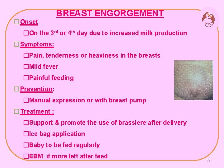 BREAST ENGORGEMENT � Onset �On the 3 rd or 4 th day due to