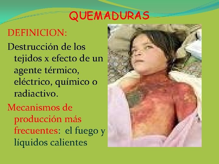 QUEMADURAS DEFINICION: Destrucción de los tejidos x efecto de un agente térmico, eléctrico, químico