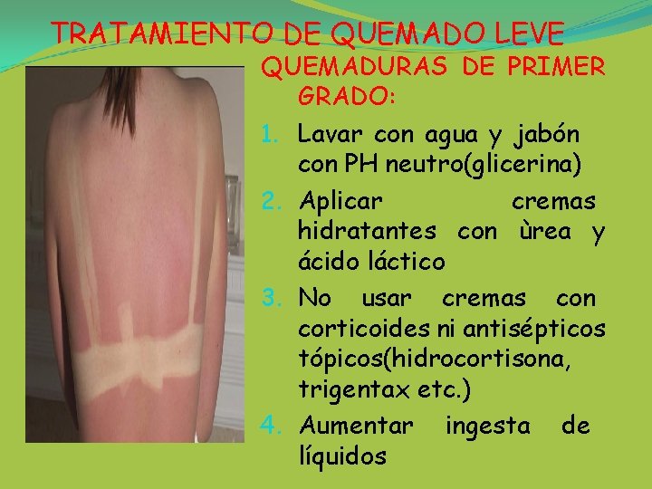 TRATAMIENTO DE QUEMADO LEVE QUEMADURAS DE PRIMER GRADO: 1. Lavar con agua y jabón