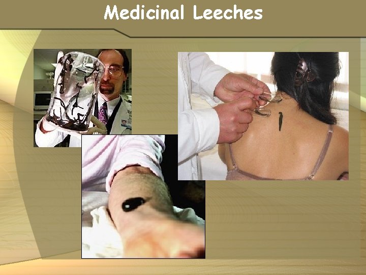 Medicinal Leeches 