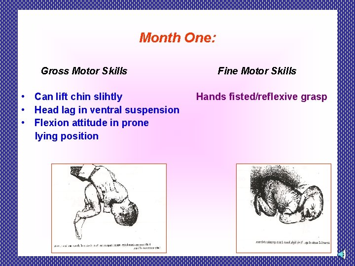 Month One: Gross Motor Skills • Can lift chin slihtly • Head lag in