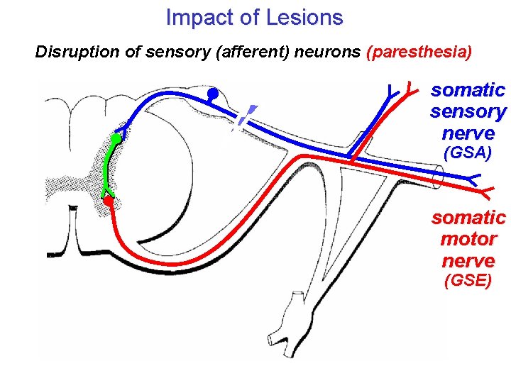 Impact of Lesions Disruption of sensory (afferent) neurons (paresthesia) somatic sensory nerve (GSA) somatic Impact of Lesions Disruption of sensory (afferent) neurons (paresthesia) somatic sensory nerve (GSA) somatic
