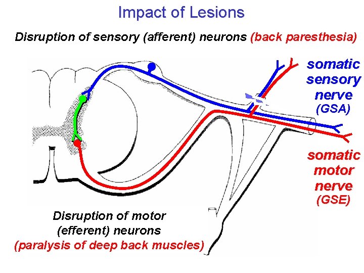 Impact of Lesions Disruption of sensory (afferent) neurons (back paresthesia) somatic sensory nerve (GSA) Impact of Lesions Disruption of sensory (afferent) neurons (back paresthesia) somatic sensory nerve (GSA)