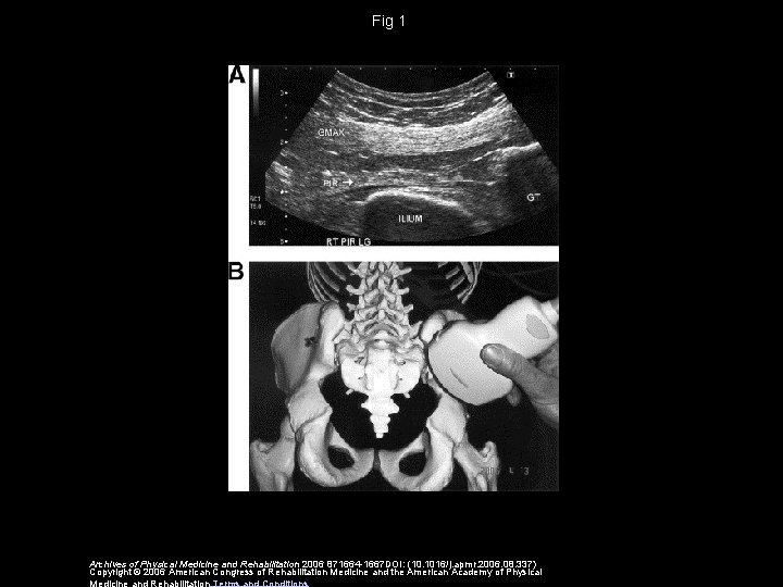 Fig 1 Archives of Physical Medicine and Rehabilitation 2006 871664 -1667 DOI: (10. 1016/j.