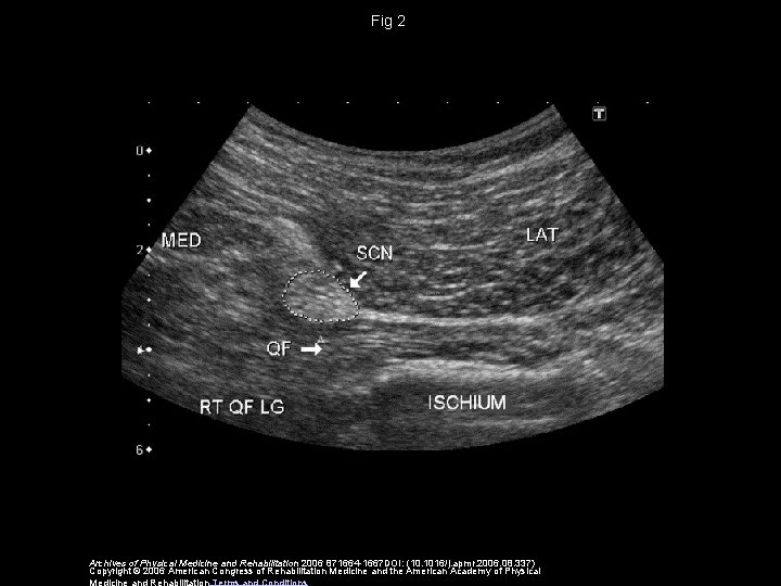 Fig 2 Archives of Physical Medicine and Rehabilitation 2006 871664 -1667 DOI: (10. 1016/j.