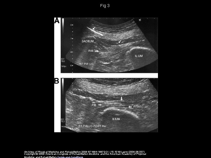 Fig 3 Archives of Physical Medicine and Rehabilitation 2006 871664 -1667 DOI: (10. 1016/j.