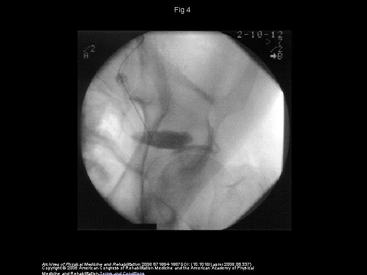 Fig 4 Archives of Physical Medicine and Rehabilitation 2006 871664 -1667 DOI: (10. 1016/j.