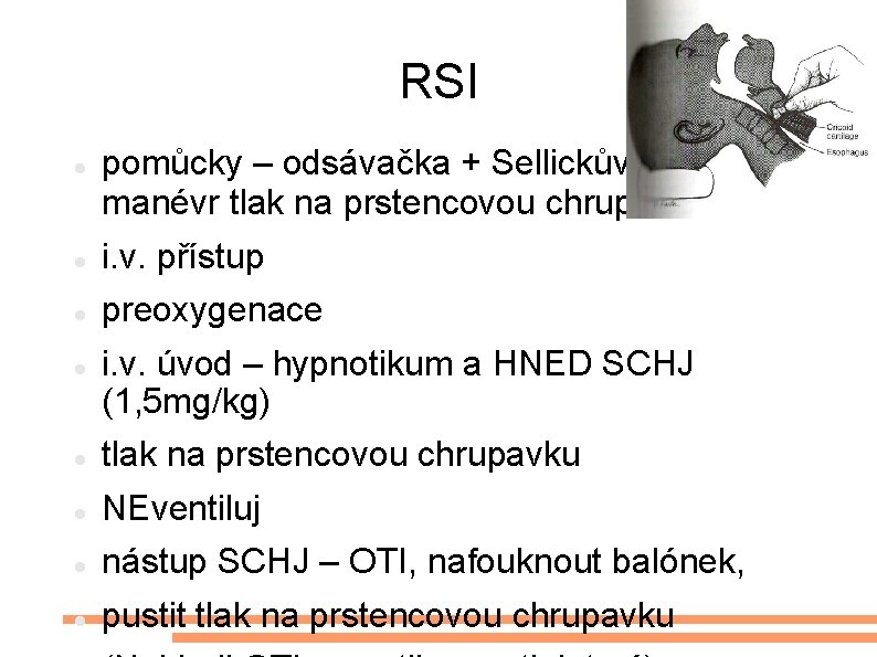 RSI pomůcky – odsávačka + Sellickův manévr tlak na prstencovou chrupavku i. v. přístup