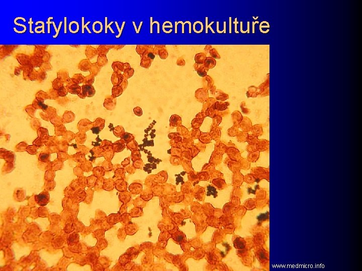 Stafylokoky v hemokultuře www. medmicro. info 