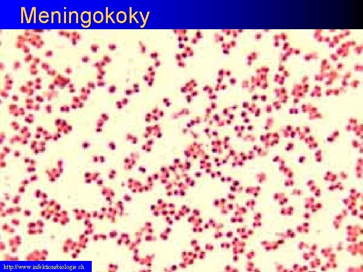 Meningokoky http: //www. infektionsbiologie. ch 