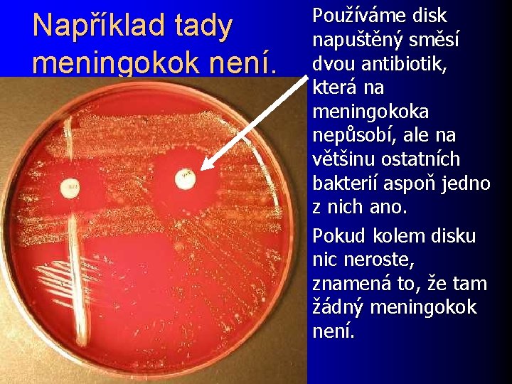 Například tady meningokok není. Používáme disk napuštěný směsí dvou antibiotik, která na meningokoka nepůsobí,