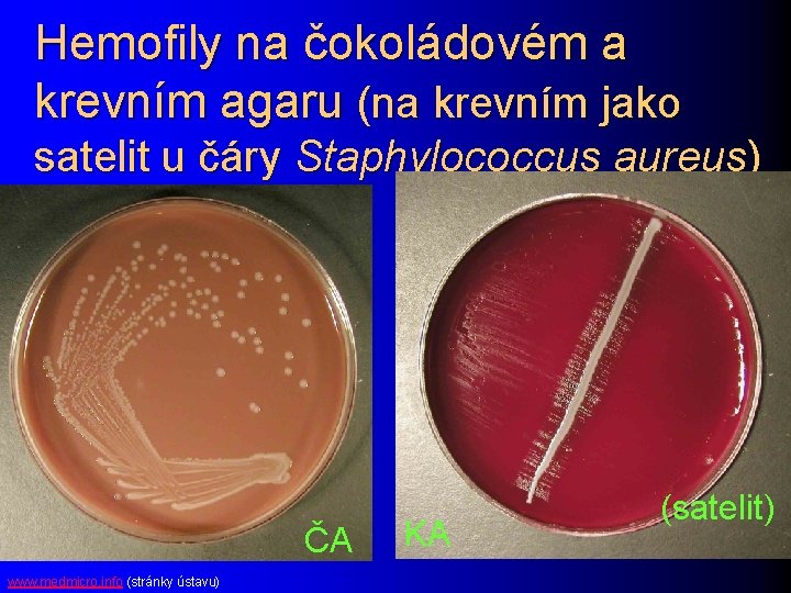 Hemofily na čokoládovém a krevním agaru (na krevním jako satelit u čáry Staphylococcus aureus)