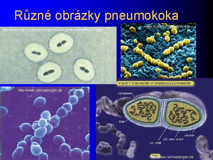 Různé obrázky pneumokoka http: //www. cbc. ca/gfx/pix/streptococcus_pneumonia 050217. jpg www. students. stedwards. edu http: