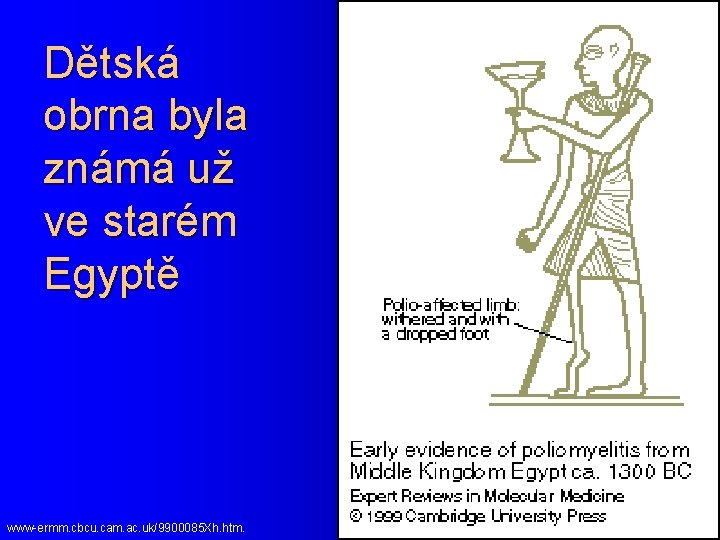 Dětská obrna byla známá už ve starém Egyptě www-ermm. cbcu. cam. ac. uk/9900085 Xh.