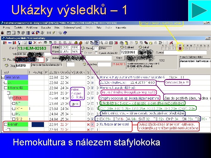 Ukázky výsledků – 1 Hemokultura s nálezem stafylokoka 