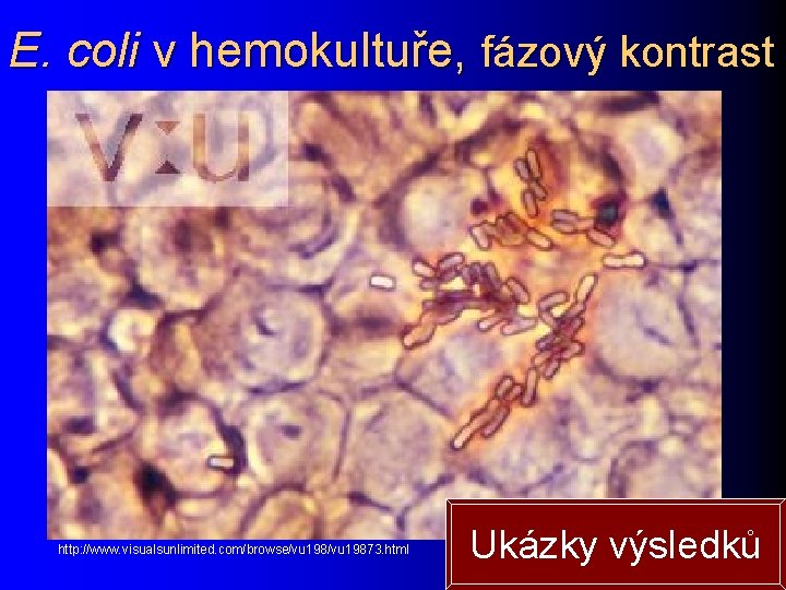 E. coli v hemokultuře, fázový kontrast http: //www. visualsunlimited. com/browse/vu 19873. html Ukázky výsledků