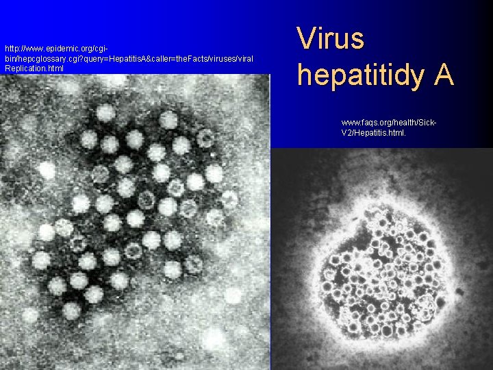 http: //www. epidemic. org/cgibin/hepcglossary. cgi? query=Hepatitis. A&caller=the. Facts/viruses/viral Replication. html Virus hepatitidy A www.