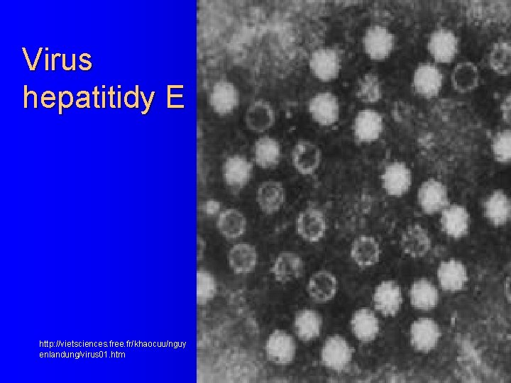 Virus hepatitidy E http: //vietsciences. free. fr/khaocuu/nguy enlandung/virus 01. htm 