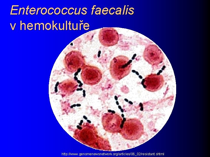 Enterococcus faecalis v hemokultuře http: //www. genomenewsnetwork. org/articles/06_02/resistant. shtml 