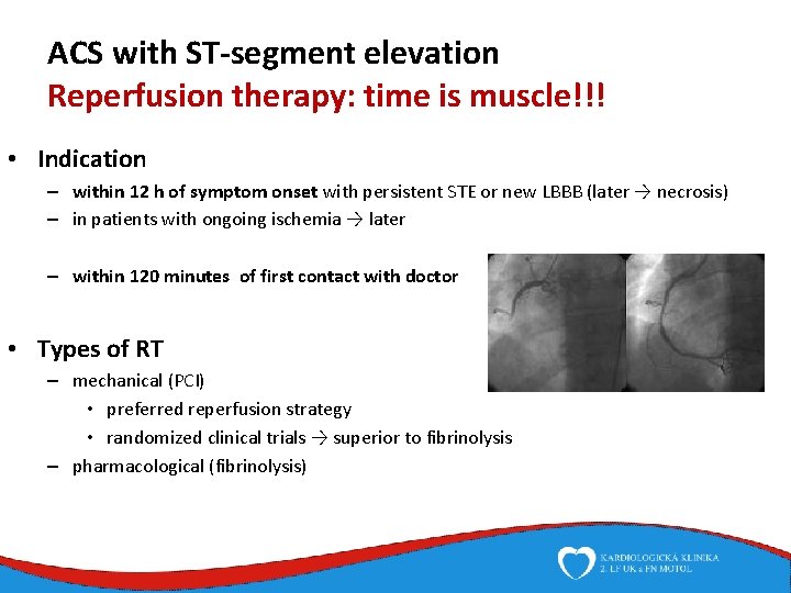 ACS with ST-segment elevation Reperfusion therapy: time is muscle!!! • Indication – within 12