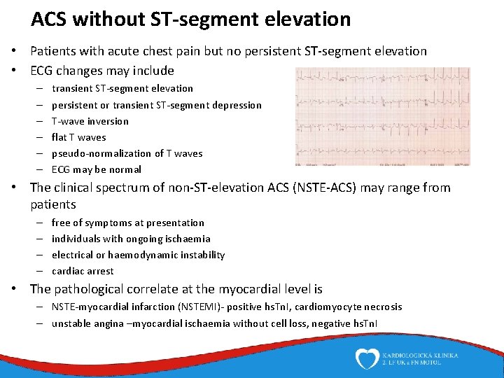 ACS without ST-segment elevation • Patients with acute chest pain but no persistent ST-segment