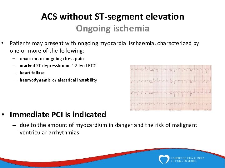 ACS without ST-segment elevation Ongoing ischemia • Patients may present with ongoing myocardial ischaemia,