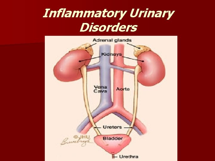 Inflammatory Urinary Disorders 