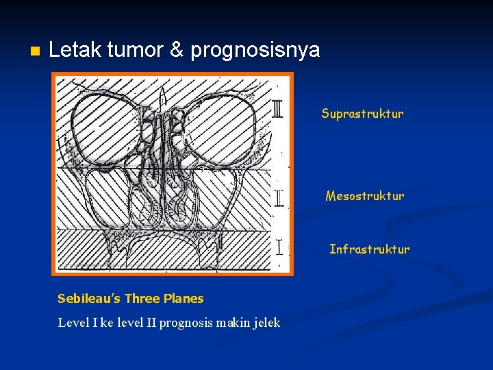 n Letak tumor & prognosisnya Suprastruktur Mesostruktur Infrastruktur Sebileau’s Three Planes Level I ke