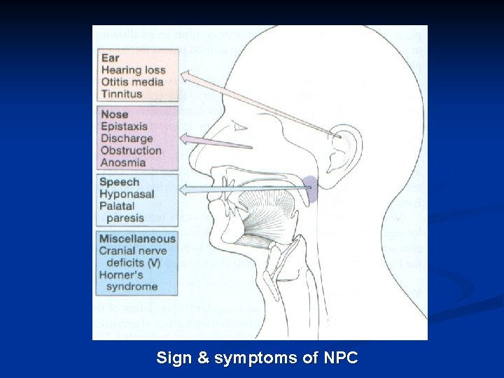 Sign & symptoms of NPC 