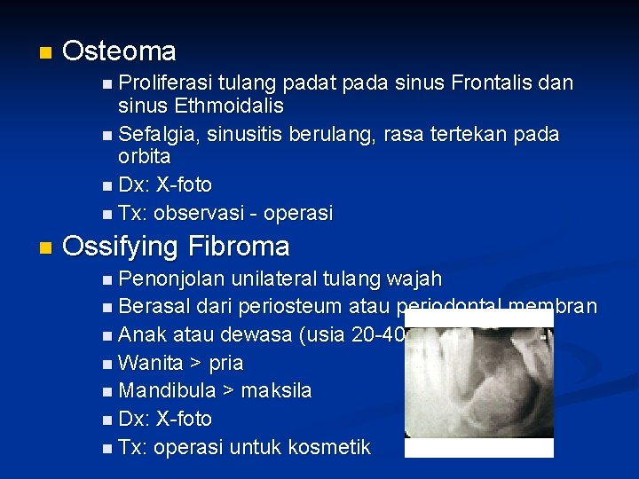 n Osteoma n Proliferasi tulang padat pada sinus Frontalis dan sinus Ethmoidalis n Sefalgia,