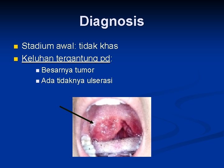 Diagnosis n n Stadium awal: tidak khas Keluhan tergantung pd: n Besarnya tumor n